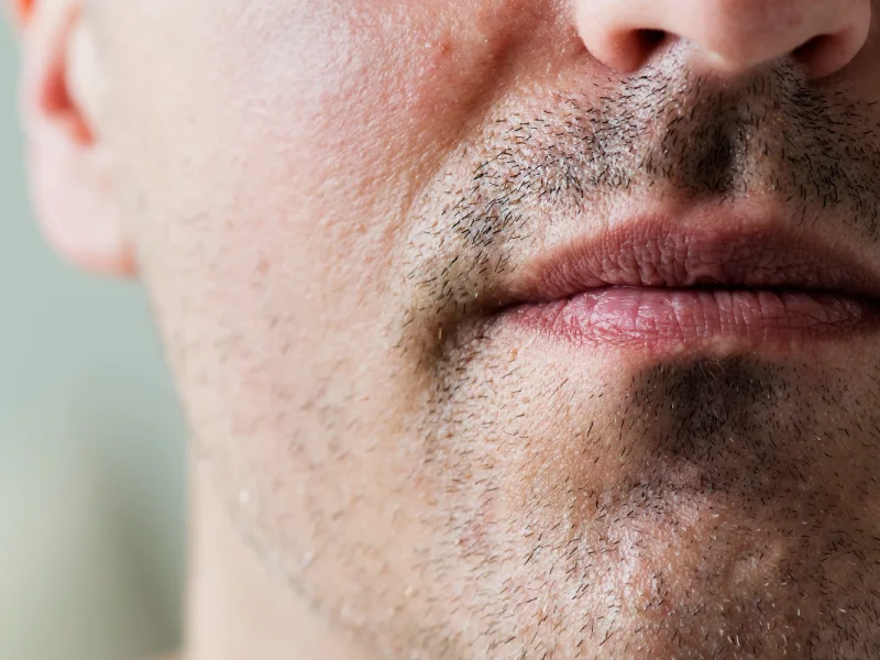 foto próxima da pele oleosa do rosto de um homem