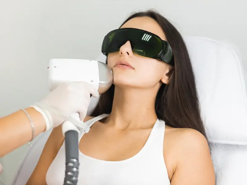 mulher a fazer depilação a laser no buço